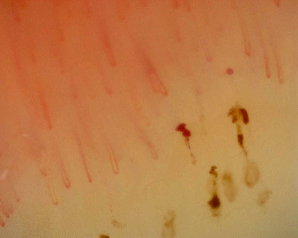 Preview image for Non-Specific Pattern: Representative Case