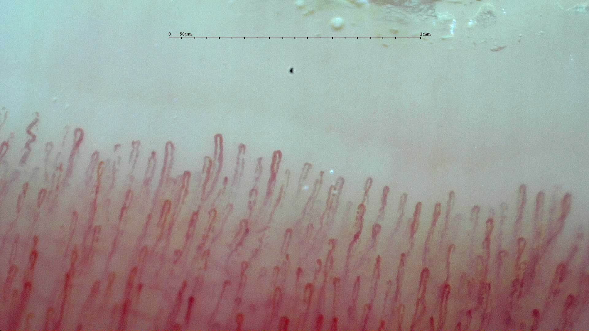 Microscope image showing a row of fine, loop-shaped capillaries