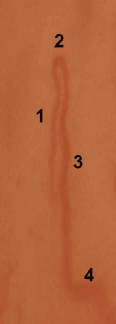 Detail of a normal capillary loop