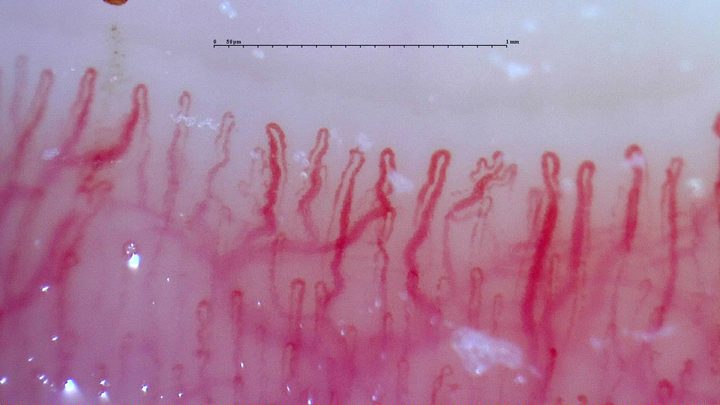 A small capillary with multiple apices right of center, beside taller hairpin loops and tortuous limbs.