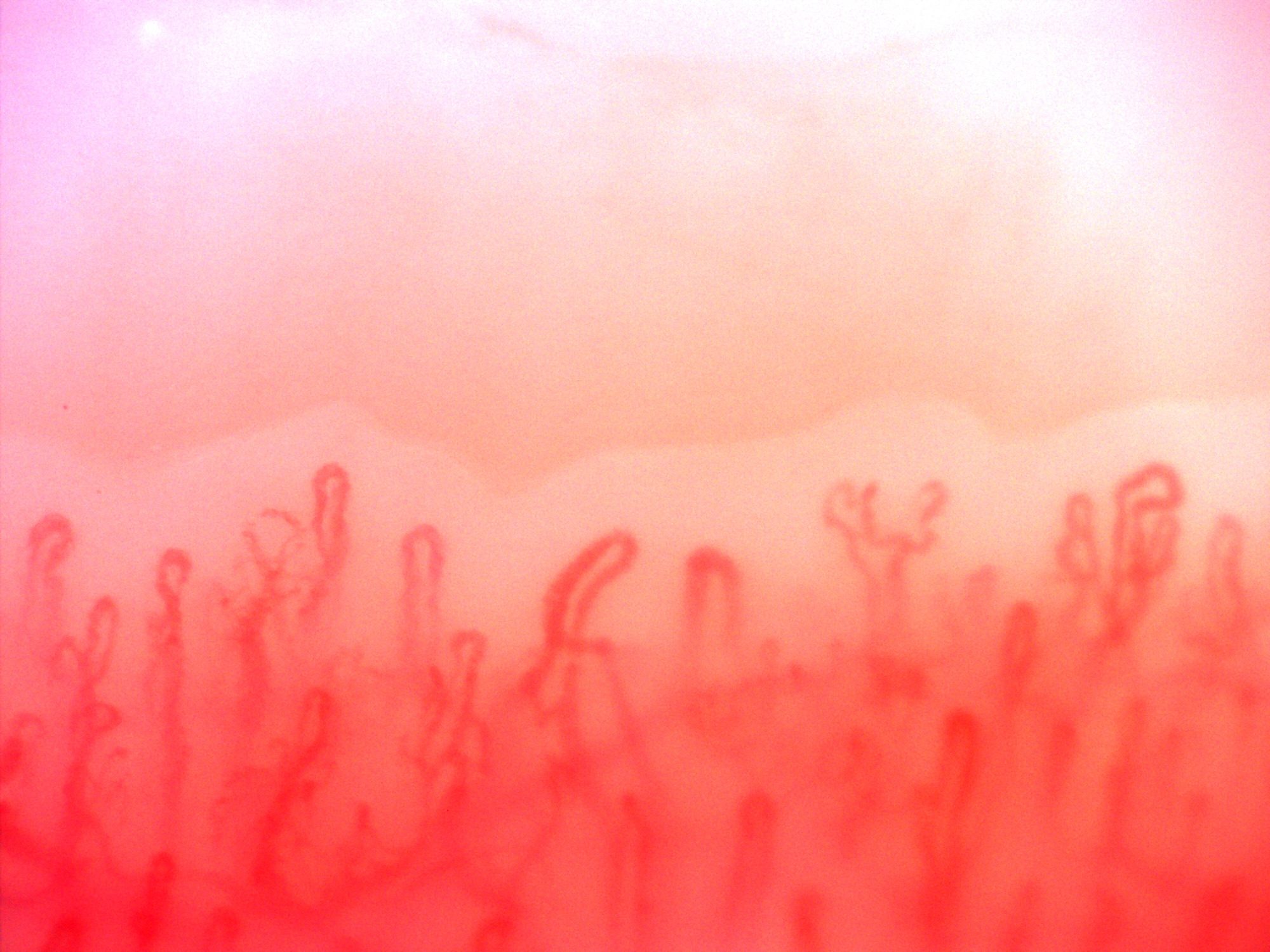 Small capillaries with multiple or bifurcated apices, mixed with simple rounded hairpin loops.