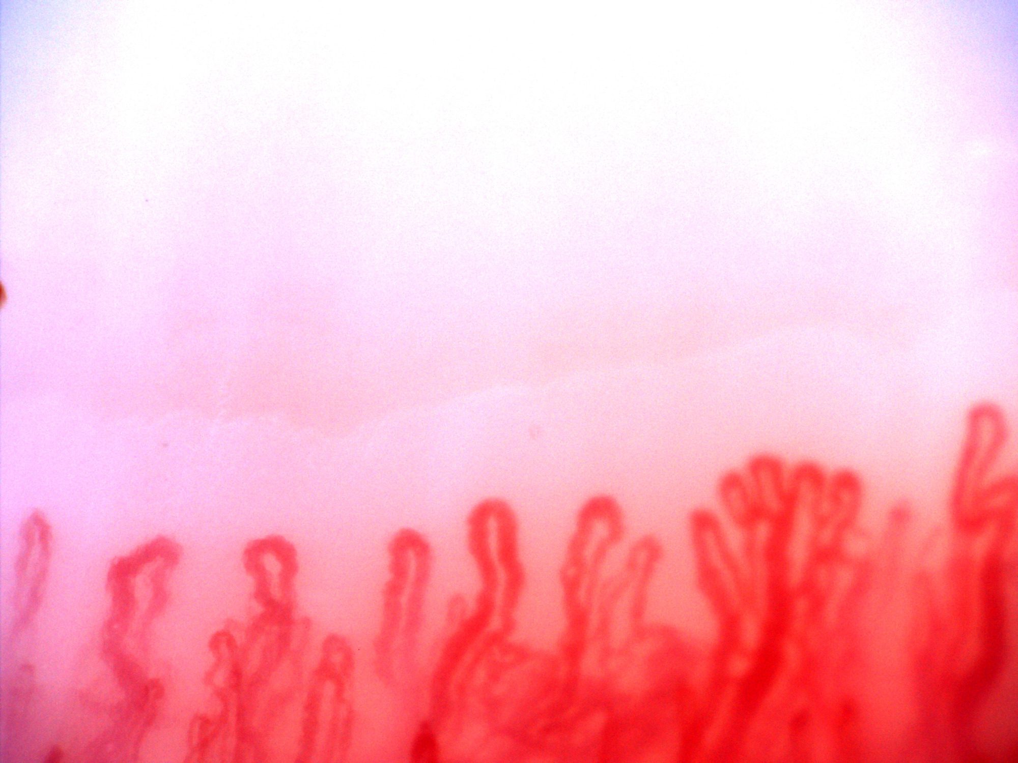 A branching capillary with several narrow apices on the right, beside thick tortuous loops on the left.