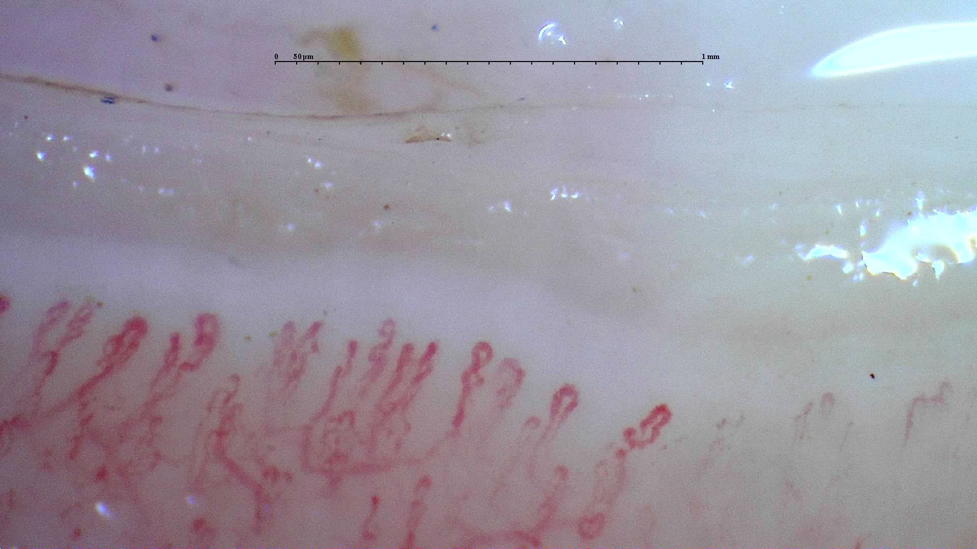 Small capillaries with multiple apices and irregular bends. Some loops overlap or are poorly defined.
