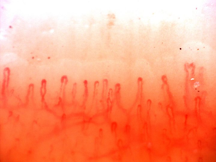 Mostly rounded hairpin capillaries, with a taller branching-appearing loop near the right edge.