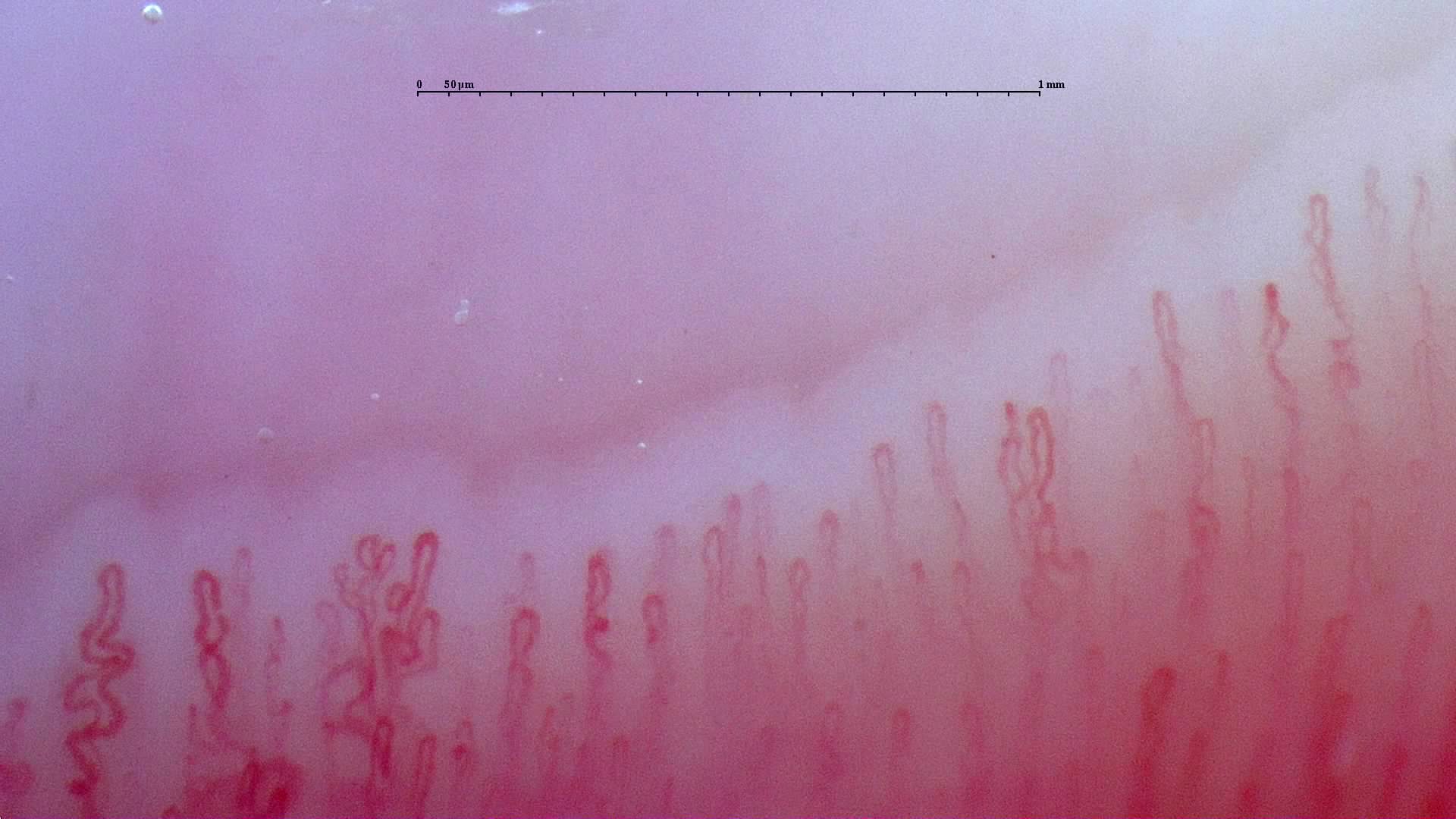 A fine branching capillary on the left, with slender hairpin loops and nearby crossed or curved capillaries.