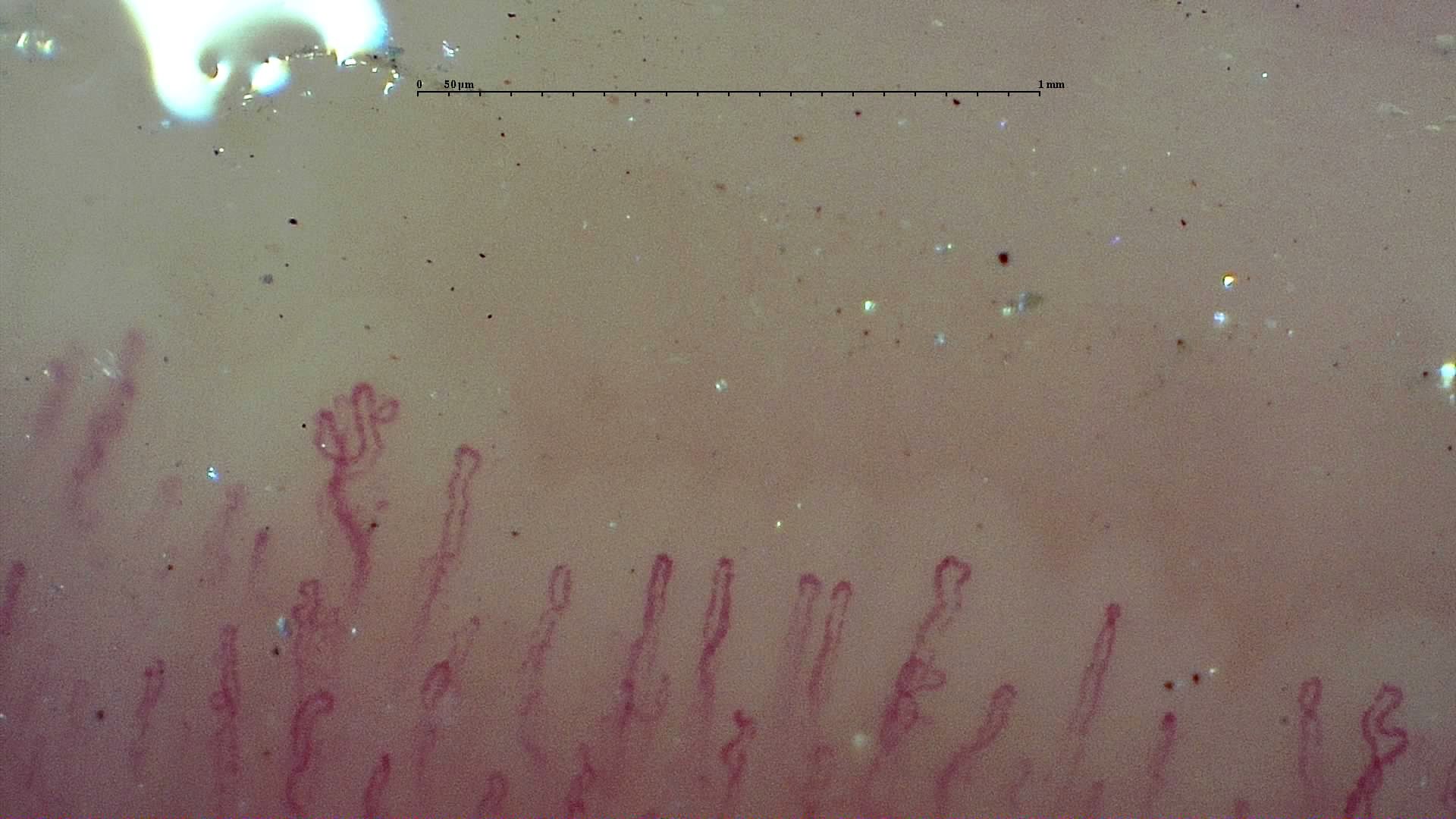 A small capillary with multiple rounded apices left of center, surrounded by slender simple hairpin loops.