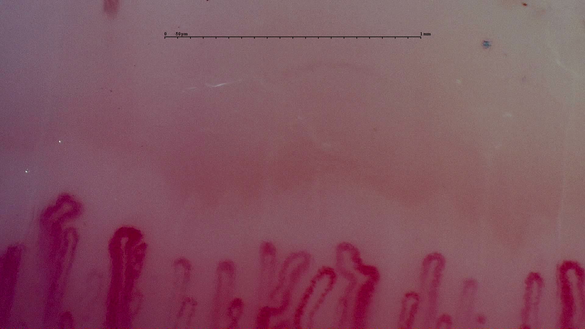 An enlarged rounded capillary apex left of center, among narrower and folded loops.