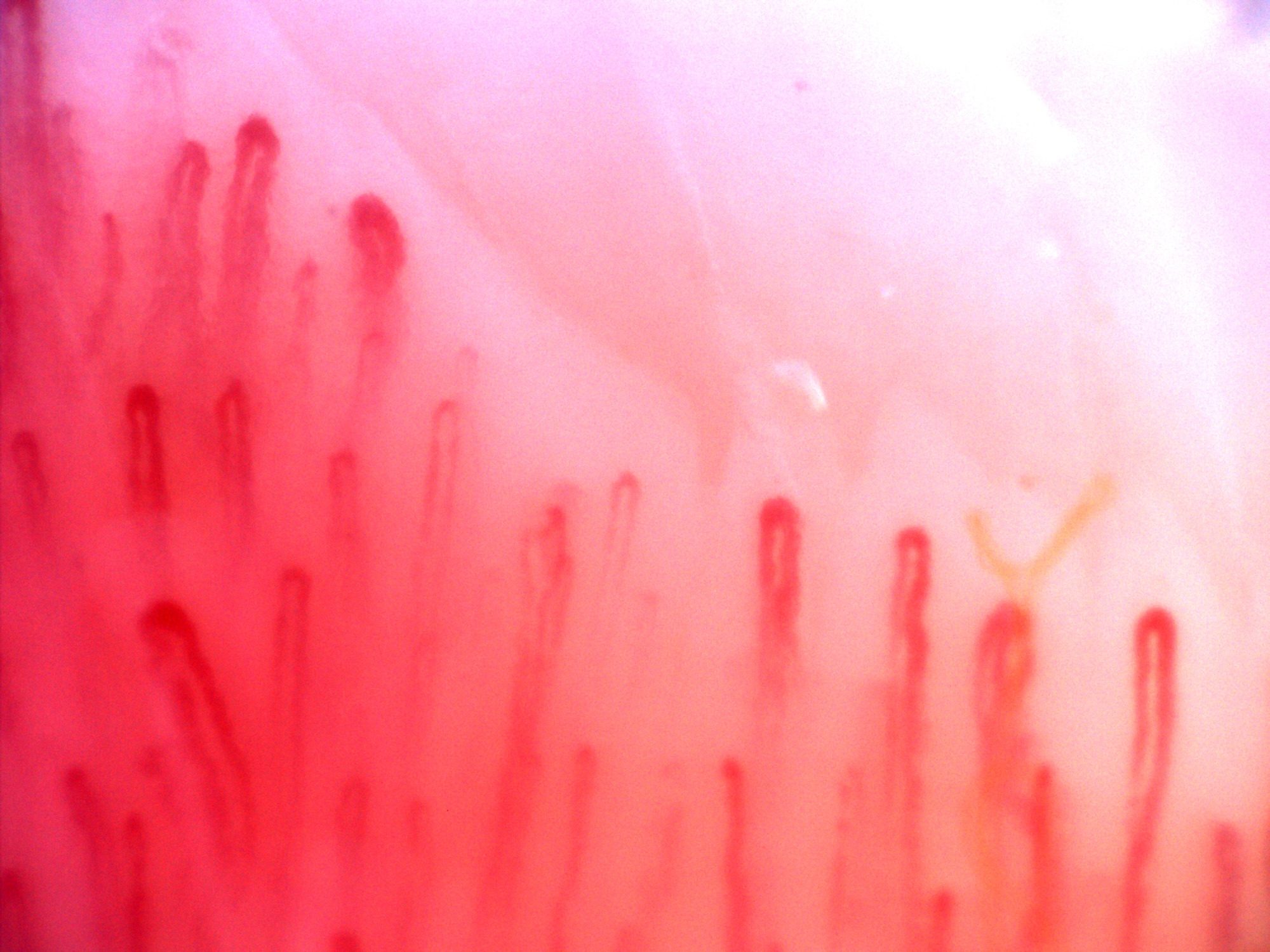 Hairpin capillaries of different lengths and apical widths. A pale surface strand overlies some right-sided loops.