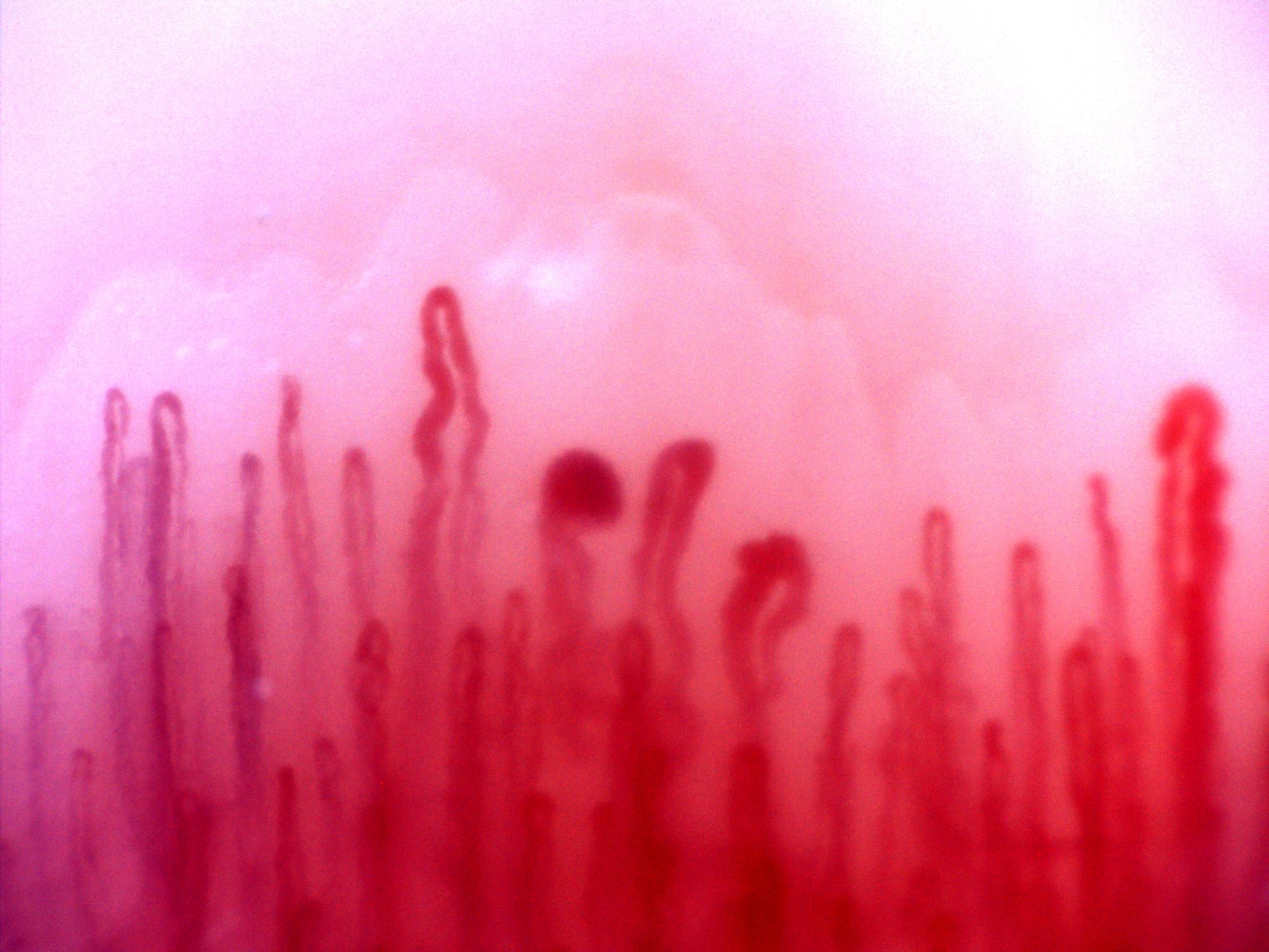 Enlarged rounded capillary apices, including one almost circular apex, above finer overlapping vessels.