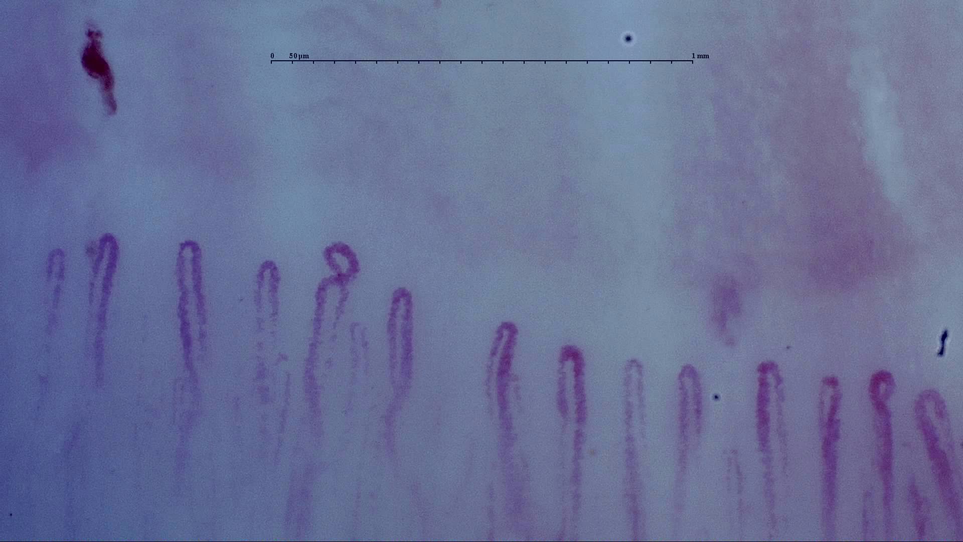 Mostly simple hairpin capillaries with one small coiled apex. An isolated elongated hemorrhage lies above the left side.