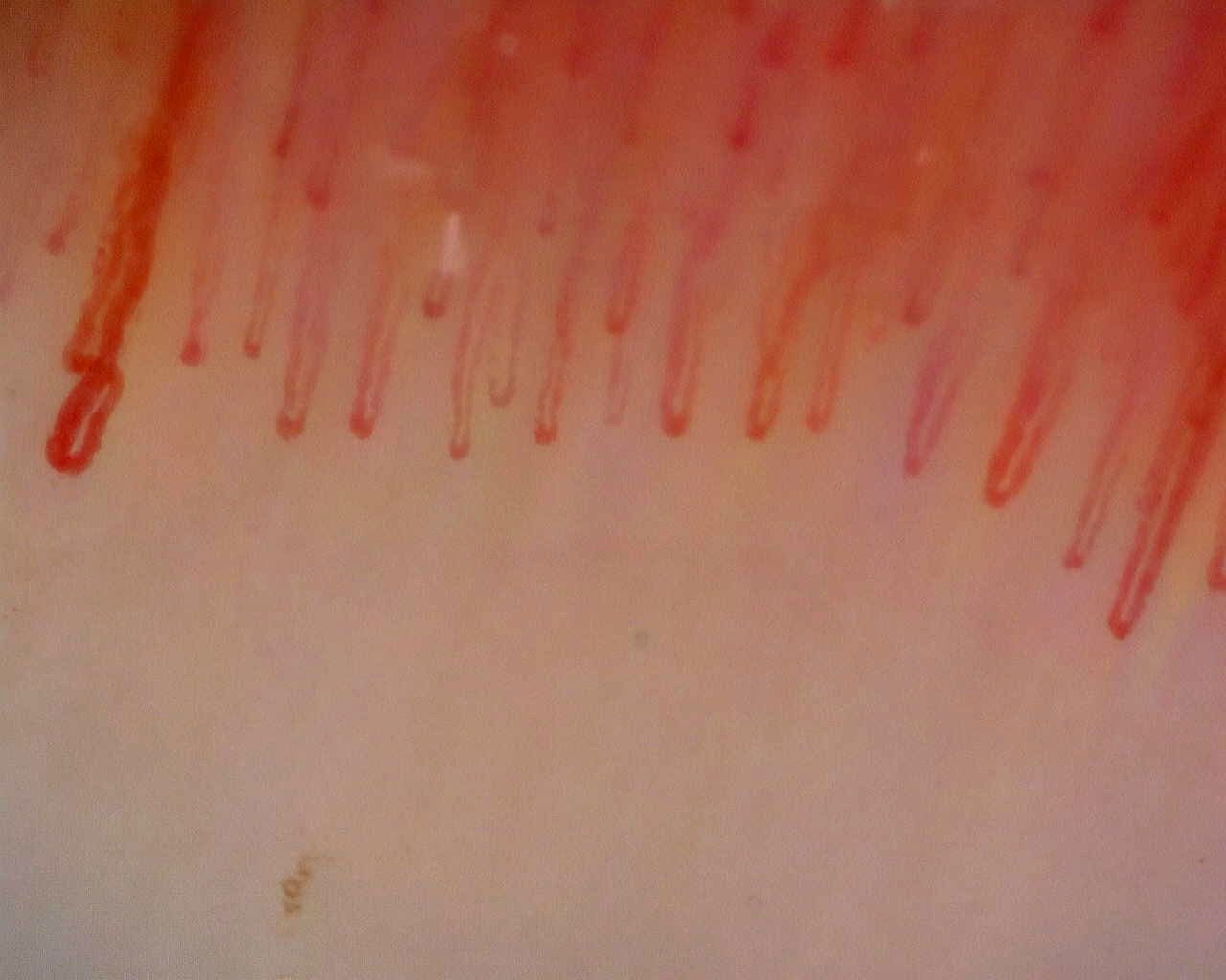 Elongated hairpin capillaries, with wider apices at the sides and finer loops in the center.