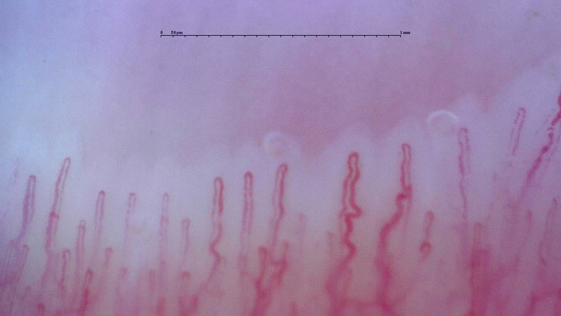 Slender capillaries with rounded apices and mildly tortuous limbs, especially right of center.