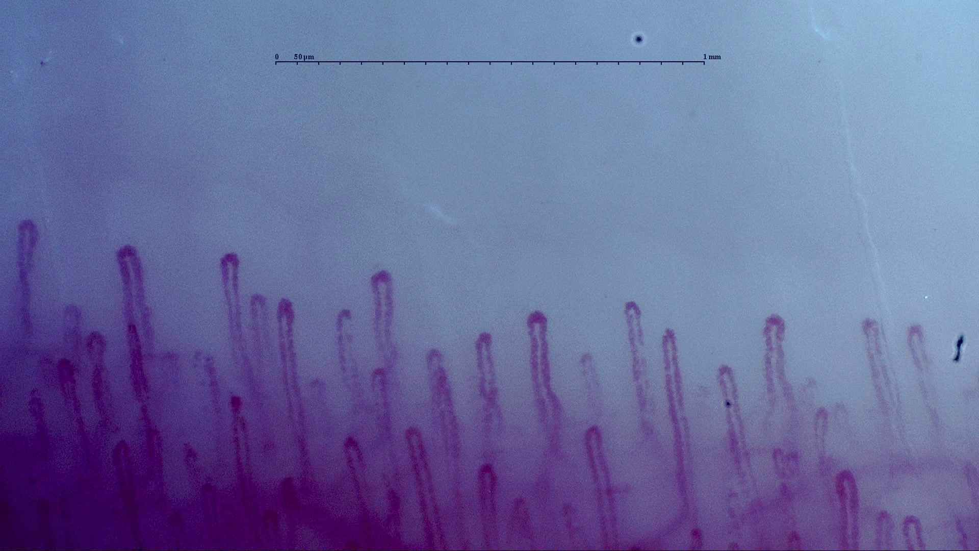 Hairpin capillaries with rounded apices, some enlarged. Finer loops are visible between them.