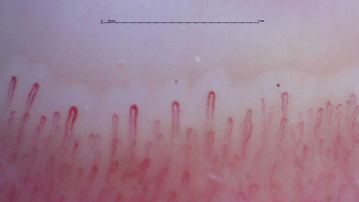 Wider hairpin capillaries on the left and finer loops on the right.