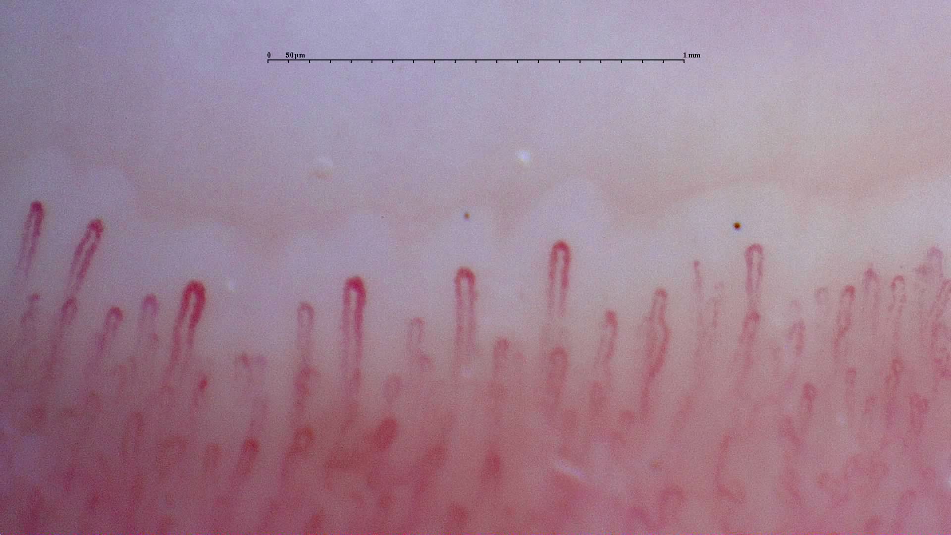 Wider hairpin capillaries on the left and finer loops on the right.
