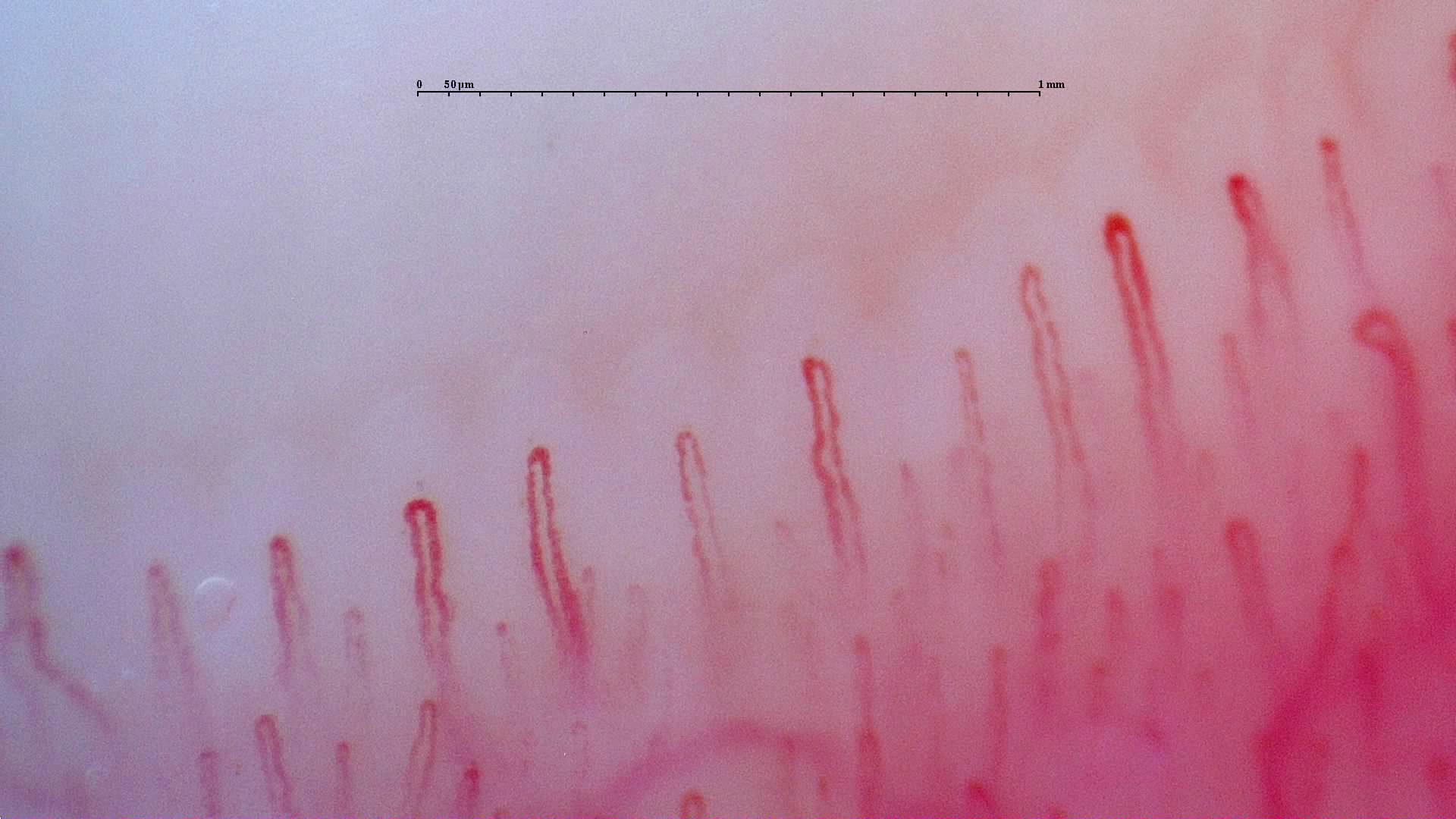Mostly simple hairpin capillaries, with some wider loops and a visible transverse vessel in the deeper plane.