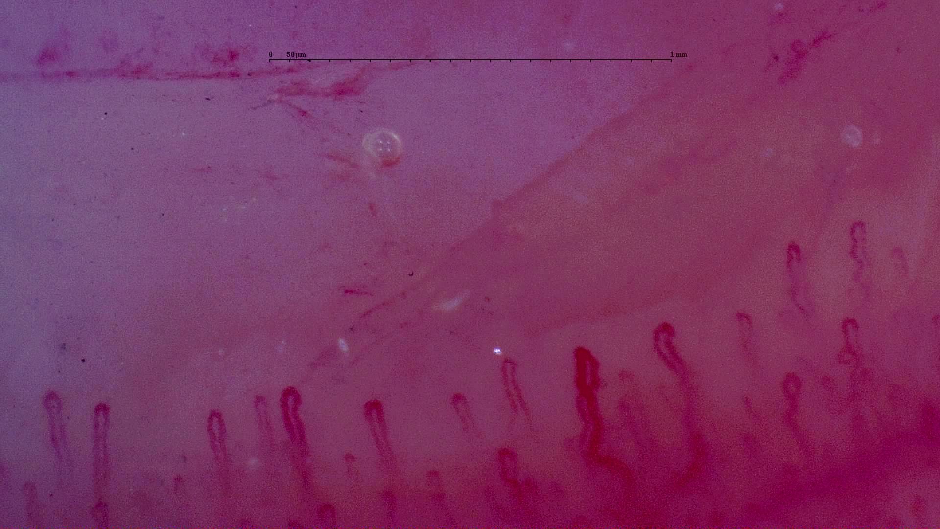 A capillary right of center has a sharp bend below its rounded apex. The surrounding hairpins are finer.