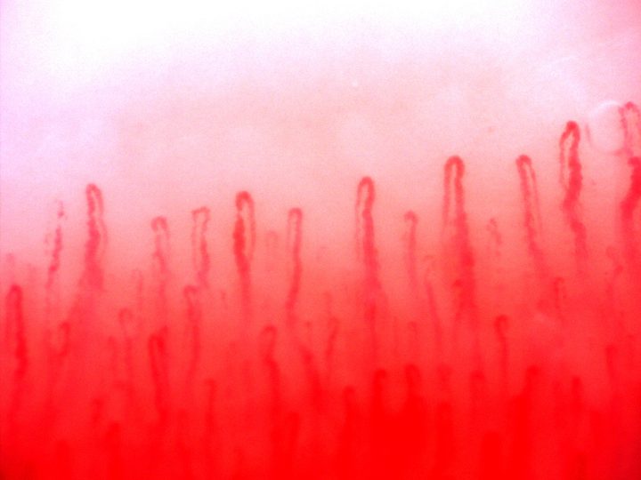 Hairpin capillaries with rounded apices at different heights and mostly aligned limbs.