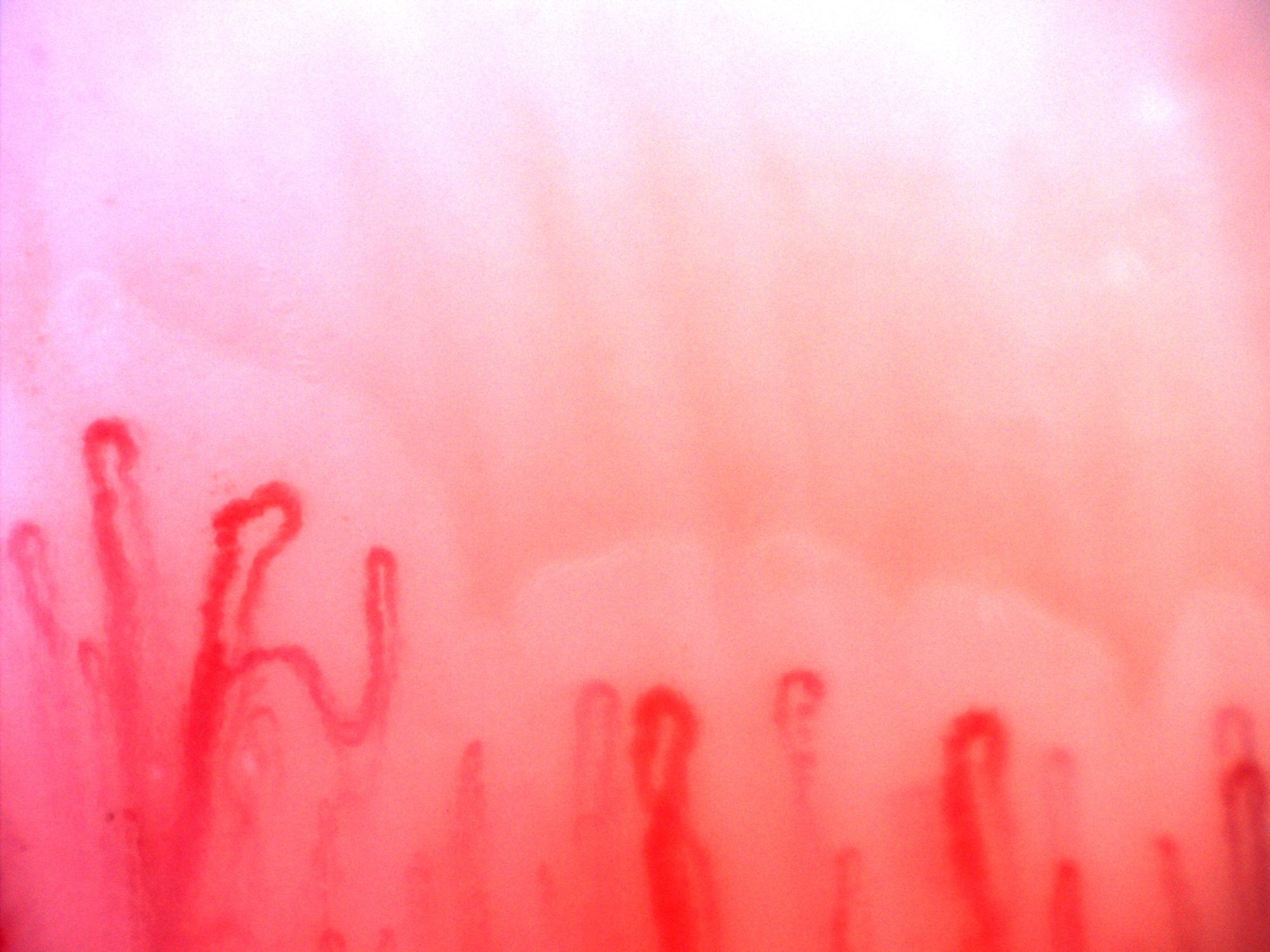 A capillary on the left has an enlarged apex and a marked lateral bend. Simpler hairpin loops lie to the right.