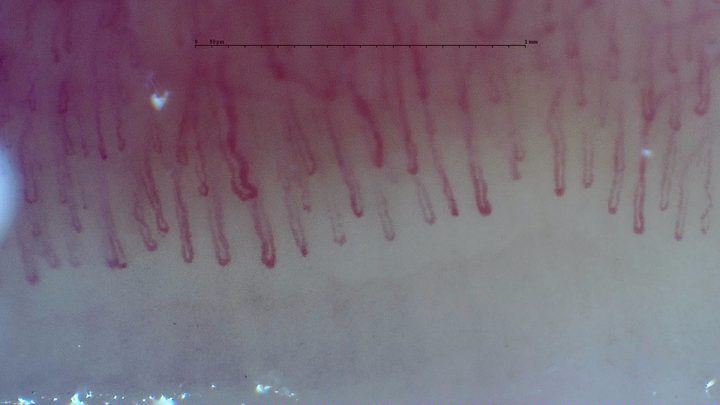 A long tortuous capillary near the left-center, surrounded by straighter elongated hairpin loops of different widths.