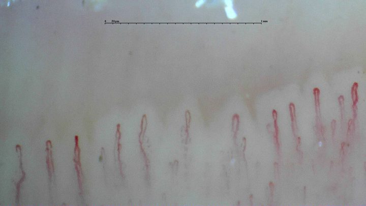 Slender capillaries with small repeated bends in their limbs and mostly rounded apices.