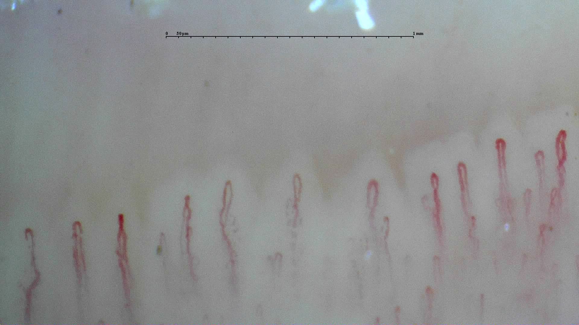 Slender capillaries with small repeated bends in their limbs and mostly rounded apices.