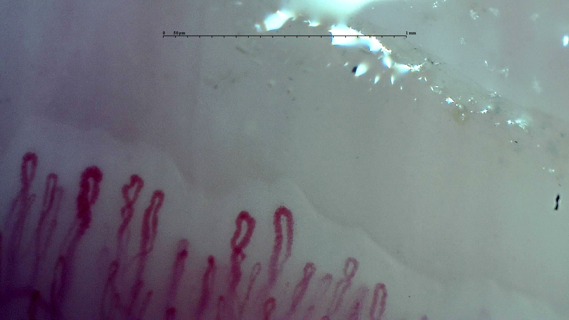 An enlarged rounded apex on the left and an oval crossed loop near the center, among narrower hairpin capillaries.
