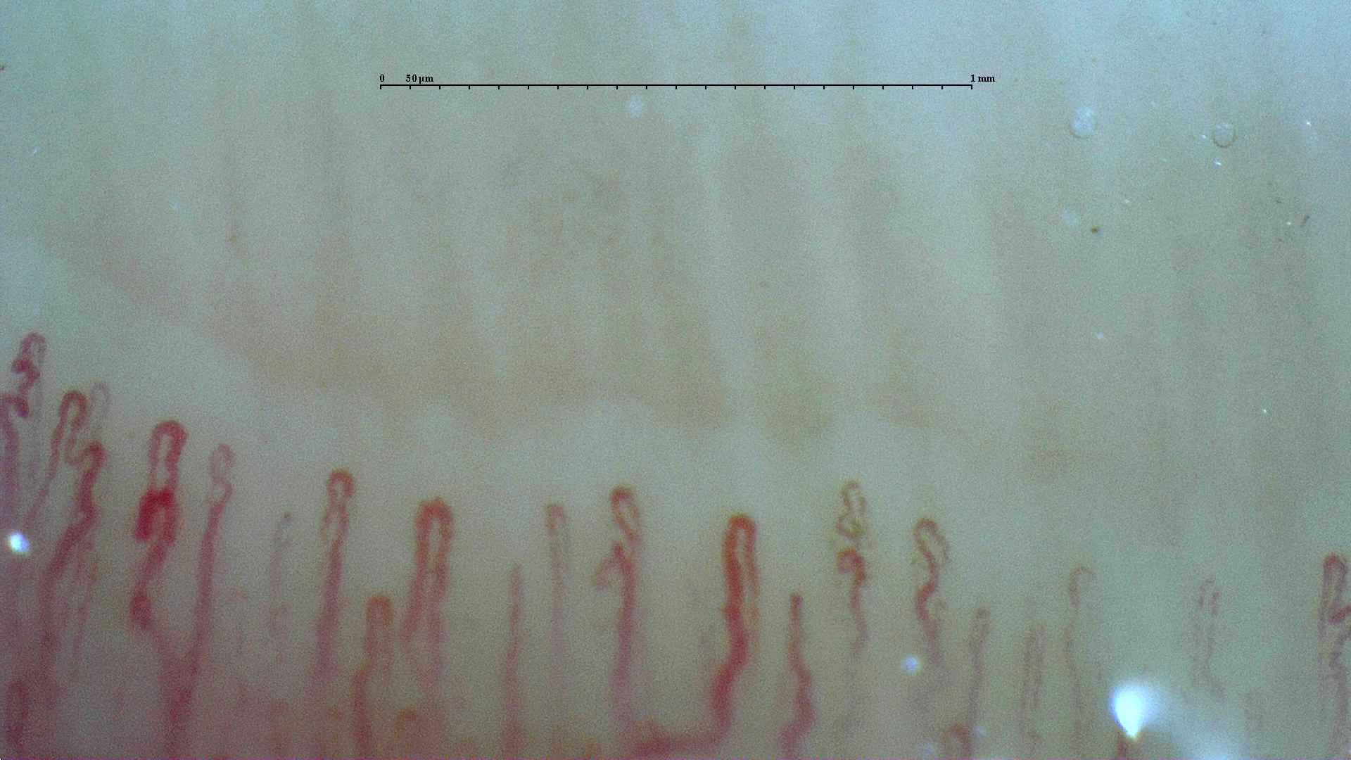 Small coiled apices beside thicker, straighter hairpin capillaries. Some limbs bend near the apex.