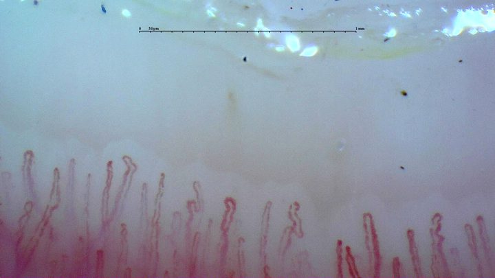 Slender capillaries with small hooked or angulated apices. Surface particles are visible above the row.
