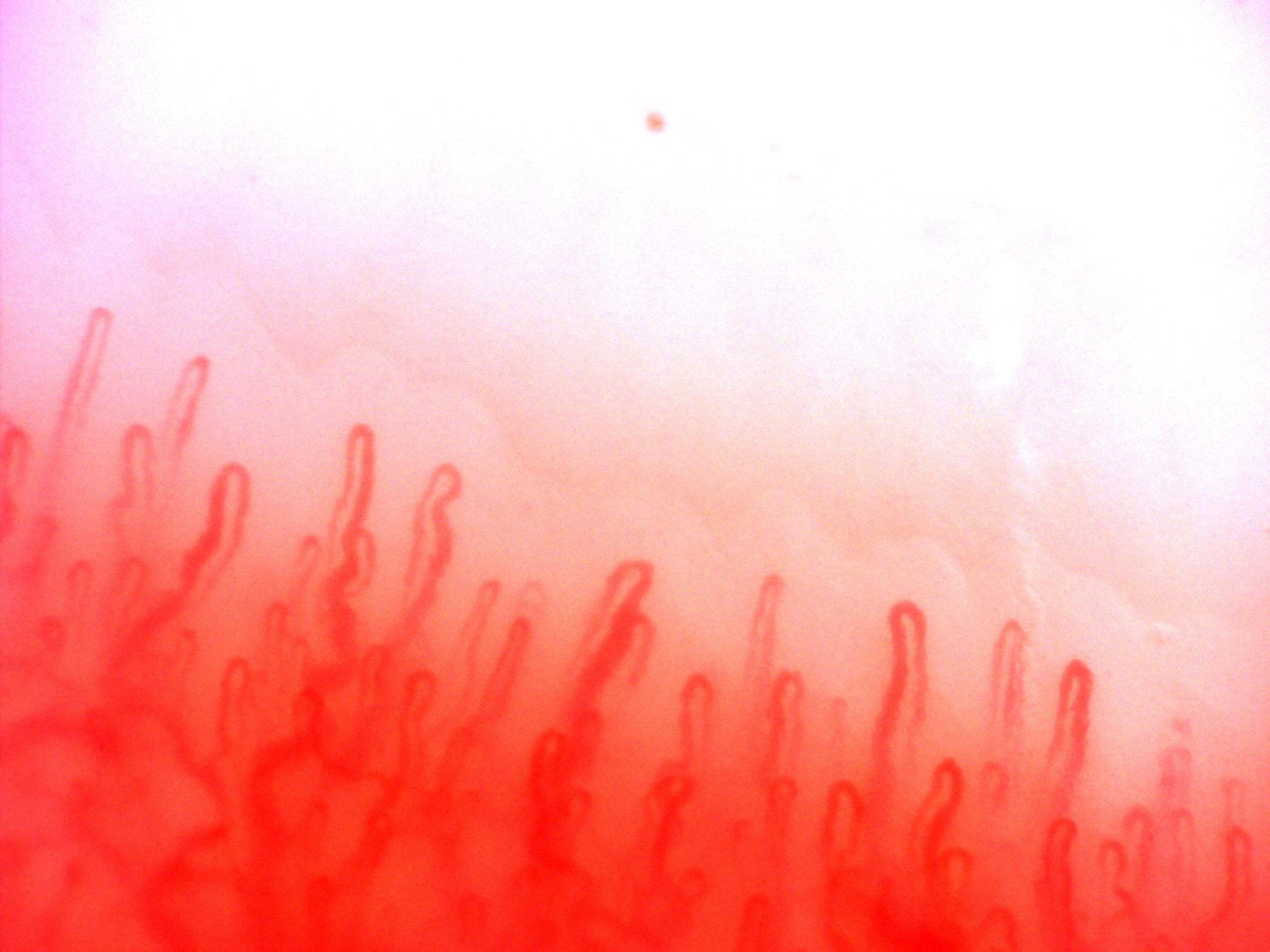 Long hairpin capillaries with narrow apices and occasional lateral bends. The deeper vessels have more curved courses.