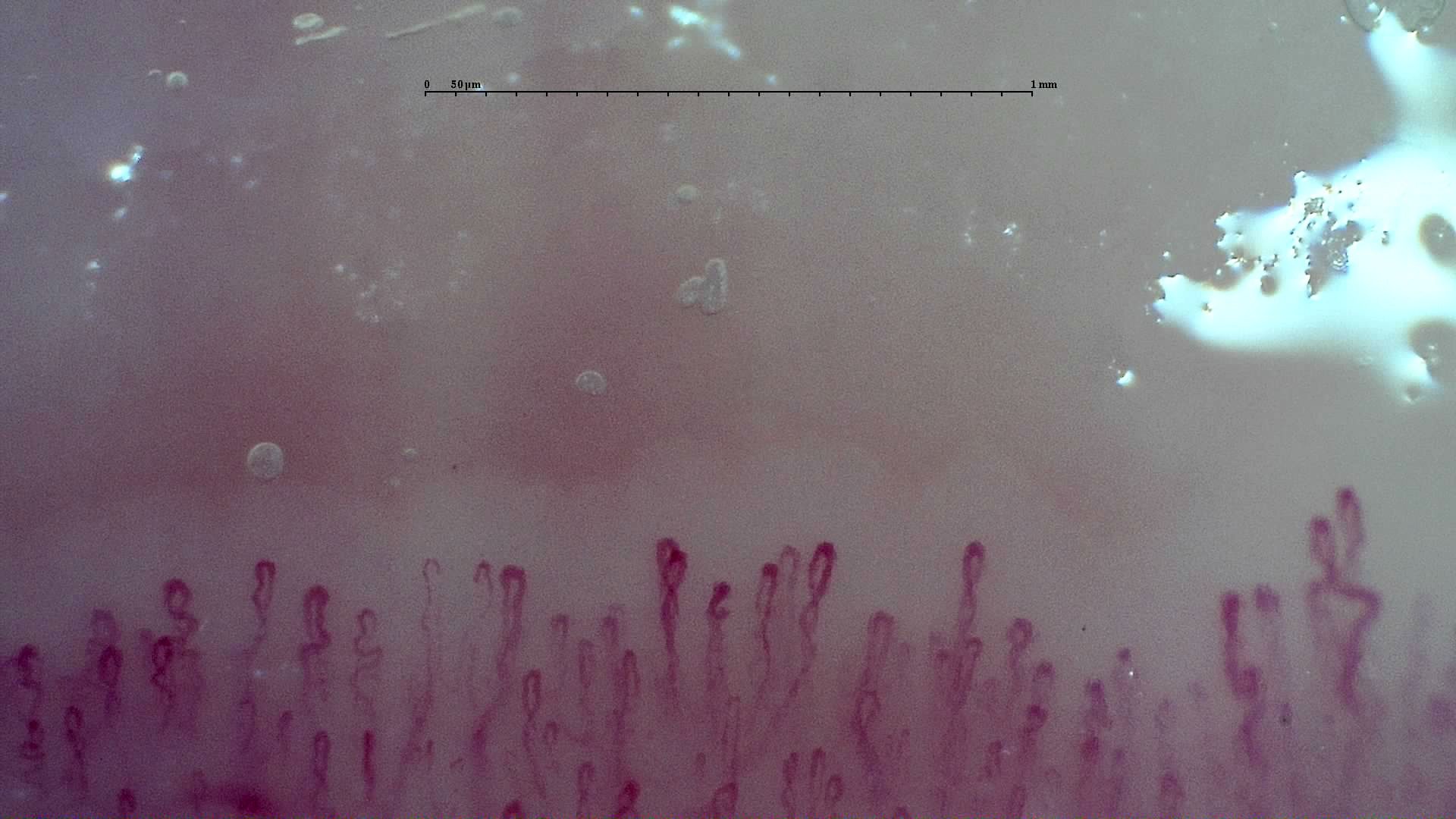 Small coiled capillary apices with occasional wider loops. A larger angulated capillary is visible at the far right.