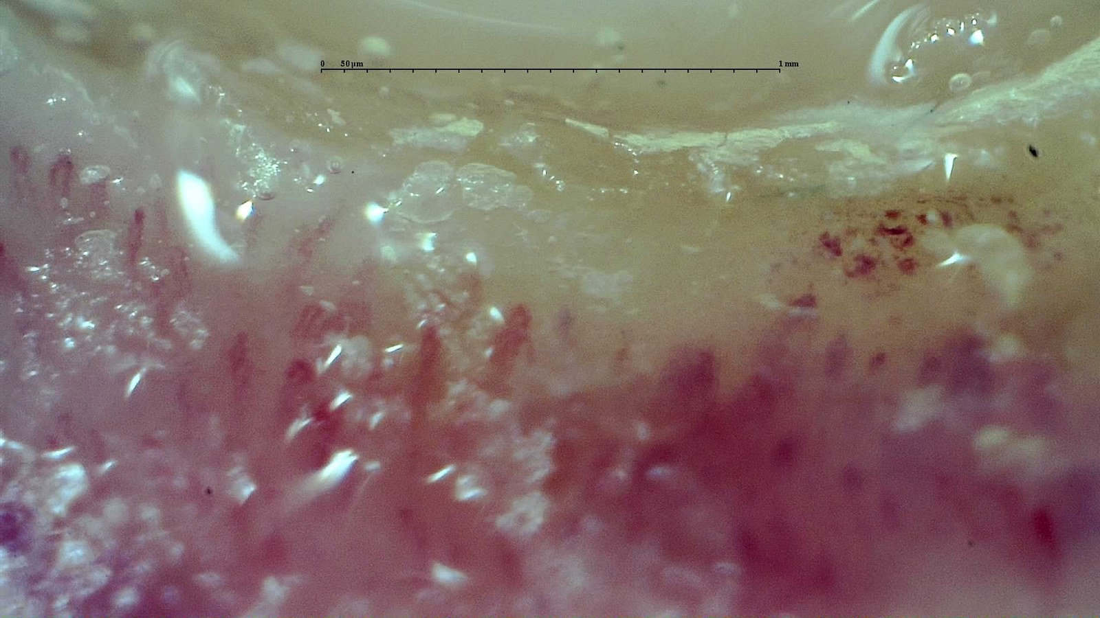 Field with reflections and poor focus making capillary assessment difficult